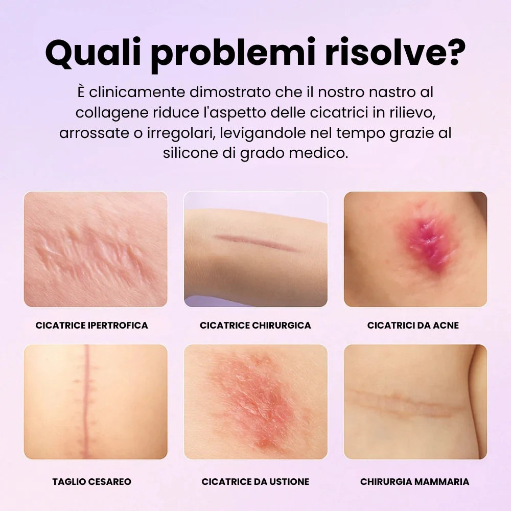 Nastro di Silicone al Collagene